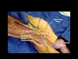 Saphenous Nerve Below the Knee