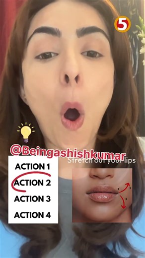 Face yoga for smile lines - share & smile reduce wrinkles today #faceyogabyvibhutiarora #skincare