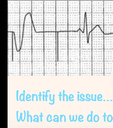 ⚡️🫀Pacemakers don’t have to be a guessing game! ⚡️🫀 This is one of those moments where slowing down and really looking matters. A few small details tell you exactly what you’re dealing with, and once you know where to look, it clicks. This isn’t about memorizing strip after strip! It’s about understanding what the device is doing and why or how the heart is responding the way it is. When you can identify the pieces correctly, your troubleshooting, interventions, and confidence at the bedside c
