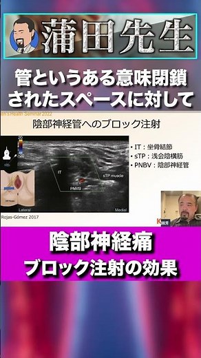 神経ブロック注射の効果持続の難しさ #Short, #セミナー, #セラピスト, #リハビリ, #神経痛, #リハビリ, #解剖学, #柔道整復師, #治療