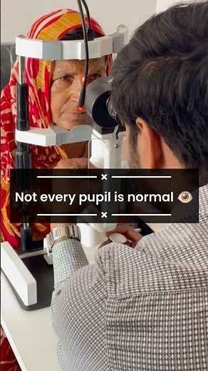 Not every pupil is normal..😳 comment below which is see you first time.? #eyes #trending #doctor