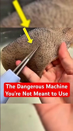 This Machine Can Destroy Your Skin