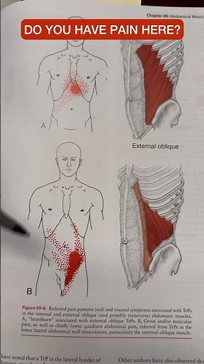 INSTANTLY Relieve Abdominal Pain With This Breathing Exercise #shorts