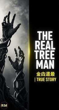 The Man With Trees Growing From His Body #seo