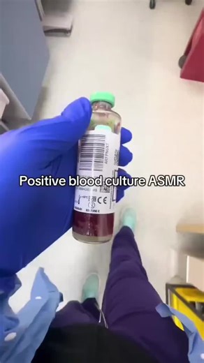 Full Procedure of Blood culture 🔬🧪💉✅ #dreamlaboratorypathologist #dreamlaboratorypathologist #dontunderreviewmyvideo @Hidayat Ullah