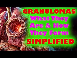 🔬 What is a Granuloma? 🦠How do Granulomas Form? Med School Pathology 🏥📚 USMLE High Yield Simplified