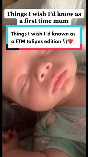 FTM talipes edition 👣❤️ #fyp #fypシ #foryoupage #fypage #mumsoftiktok #mumlife #mumtok #mumsontiktok #talipesawareness #talipes #talipesbaby #talipesjourney #talipesequinovarus #ourtalipesjourney #clubfoot #clubfootjourney #clubfootbaby #firsttimemum #firsttimemom #pregnancyworries #raisingawareness #talipesawareness #clubfootawareness