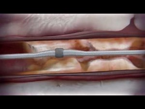 CSI Diamondback 360®