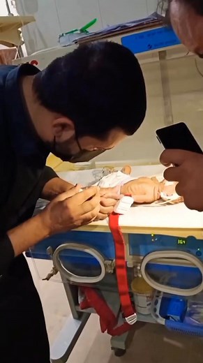 Malnourished Newborn Cannulation. #knowledge of #blood #sample #nursing #students #medicalstudent #medicaleducation #nurse #doctor #public #hospital #patientcare #hospital #hospitality #nursing #ActionMovie2024 #healthcareheroes #nurselife #sutureremoval #goodnurse #ORnurse #RN | Nursing Academy