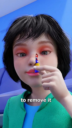 Zack D. Films | Lego Stuck In Nose For 26 Years 😨 | Instagram