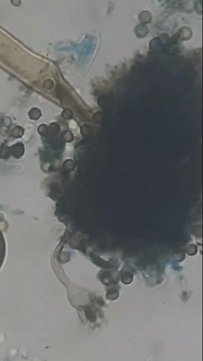 Aspergillus niger morphology demonstration
