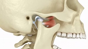 Temporomandibular Joints Dislocated Articular Disc Medically Accurate Animation