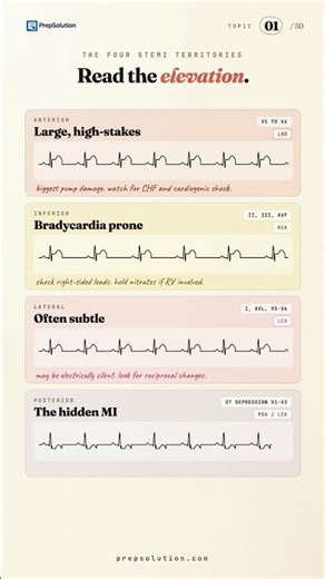 CCRN Exam Practice | STEMI | The 1mm ST Rule | Pass the exam first time