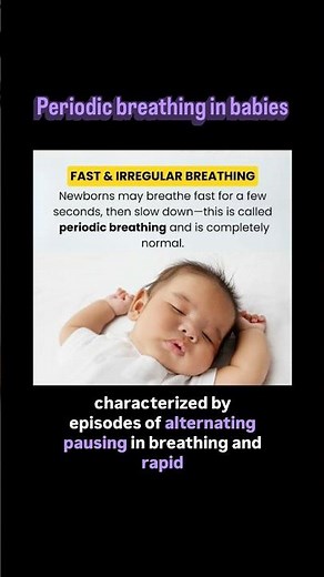 Periodic breathing in babies..!? #baby #newborn #neonatalcare #pediatrics #breathing #mbbs #usmle