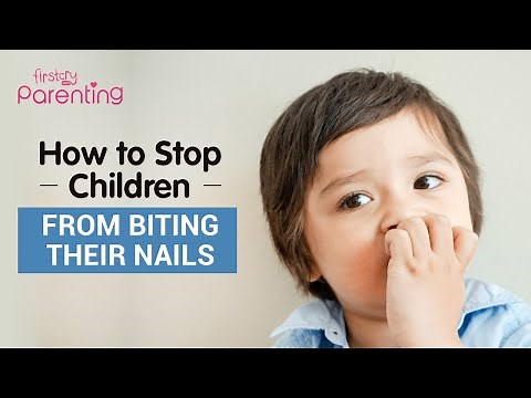 How to Stop Nail Biting in Children (7 Useful Tips)