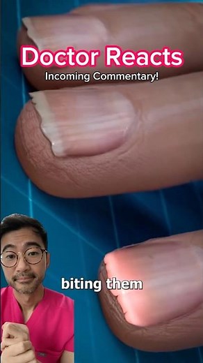 What Happens When You Bite Your Nails (Doctor Reacts + Commentary)
