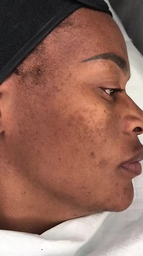 GreenAlgaePeeL على TikTok