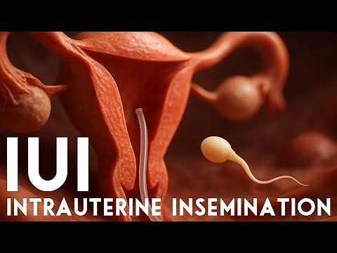 IUI Treatment: Is It Right for You? Cost, Process, and Success Rates Explained