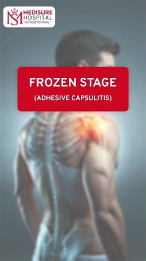 Frozen Shoulder Symptoms & Causes | Adhesive Capsulitis Explained in Simple Terms