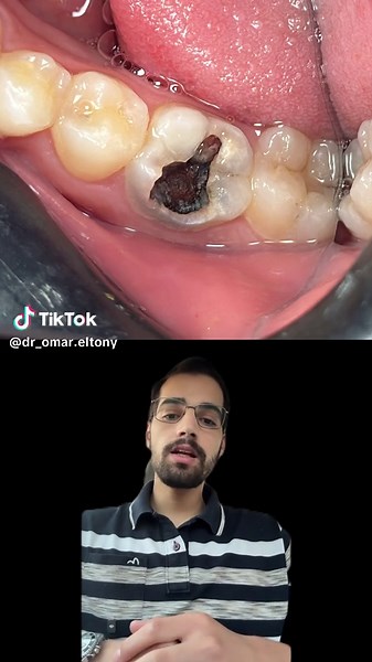 Comprehensive Dental Case Review on Tooth Extractions