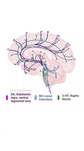 @biochemistry_nutrition_medlab on Instagram‎: "Monoaminergic signaling in the human brain.🧠The mono- aminergic systems highly overlap across brain regions implicated in ADHD,especially the cortex,midbrain,& brainstem.🧠The rate-limiting step in 5-HT synthesis is conversion of tryptophan to 5-hydroxytryptamine(5-HTP) by tryptophan hydroxylase(TPH),which has two isoforms, TPH1 & TPH2;however,TPH2 is the only isoform produced by serotonergic neurons in the brain.In addition to its ra