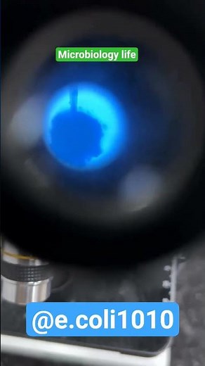 aspergillus fungus🍄‍🟫#microbiology #lablife #labtechnician #medicalstudent ‪@e.coli1010‬ #lablife