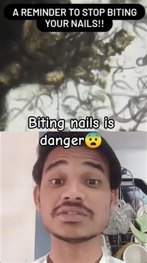 Hidden Bacteria in Your Nails: Microscope Test 🔬🚫​