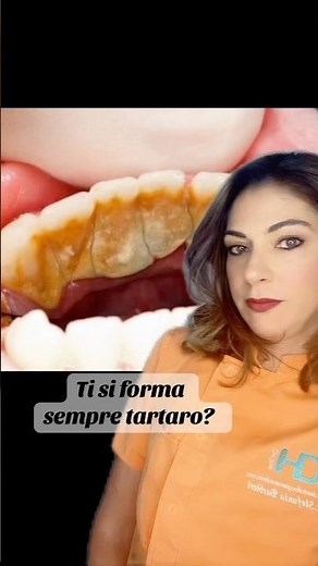 Soluzione NO TARTARO