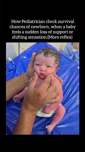 Moro reflex check healthy baby central nervous system #medicaleducation