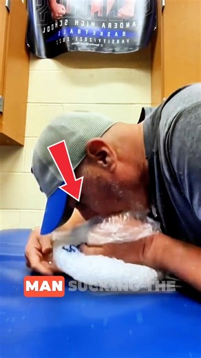 Why People Suck the Air Out of Ice Bags 🧊 It’s not to make the ice last longer—it’s to create a better cold compress. Removing the air helps the ice wrap tightly around injuries, giving athletes more effective cooling and faster relief. A simple trick with powerful results! Credits : @scottpygeorge9018, /YT monroecentralat, /TKTK #Sports #Recovery #safetyfirst #usa #treatment | Guppy News