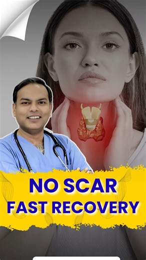 Large Toxic Goiter ka Non-Surgical Treatment | Thyroid Artery Embolization | Dr Arun Gupta