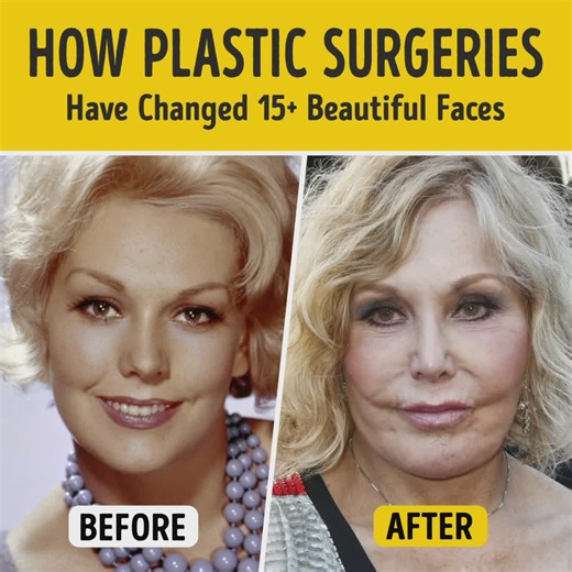 How Plastic Surgeries Have Changed 15 Beautiful Faces of Famous Ladies | You're Gorgeous