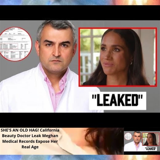 SHE'S AN OLD HAG! California Beauty Doctor Leak Meghan Medical Records Expose Her Real Age | Hunter Fishing