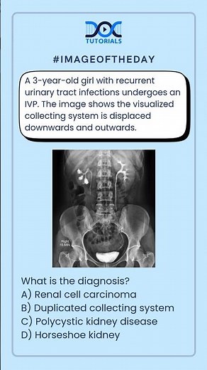 👉 What is the diagnosis?