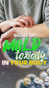 37K views · 107 reactions | Signs mold may be impacting your health. Comment the word “MOLD” and ill send you my guide on how to fight mold toxicity. | Certified Health Nut | Facebook