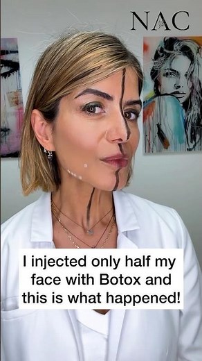 #daobotox #nefertitinecklift #neckbotox #botox #botoxtraining #nefertitinecklift #drbitafarrell