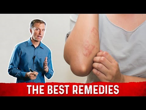 Detox and Die-Off: The Herxheimer Reaction