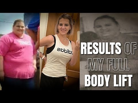 Results of my Full Body Lift