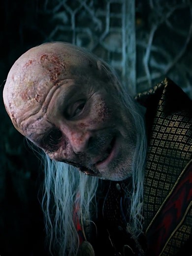 He Never Truly Healed from It 💔😔 | Daemon x Viserys | House of The Dragon