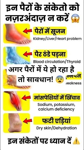 पैर बता रहे बीमारी 😨 Body Alert#shorts