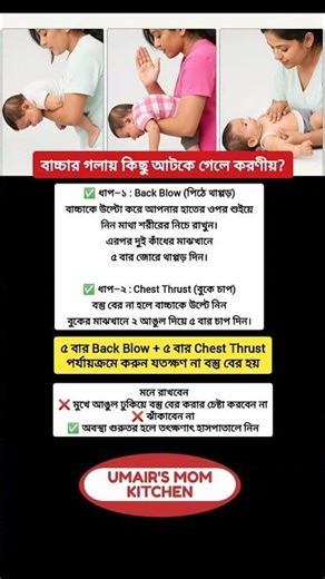 বাচ্চার গলায় কিছু আটকে গেলে করনীয় | Infant Choking First Aid | Kids Health Videos #shorts