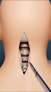 Best explanation 😲👀 . . . . . . #animation #animationvideo #animationmeme #animationart #animationstory #animationreels #animationchallenge #fbreels2024 #fbreelsviral #fbreelsfypシ゚viralシ #fbpost2024 #fbreelsfypシ゚ #fbreelsvideo | Mrp Roy