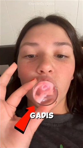 Tried to Plump Her Lips With a Glass, the Results Are Shocking!