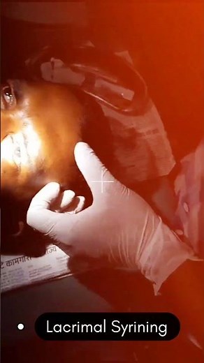 Lacrimal Syringing - technique & interpretation #ophthalmology #lacrimaldac