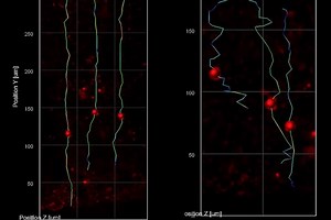 Advanced imaging reveals mired migration of neurons in Rett syndrome lab models