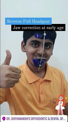 Reverse pull head gear
