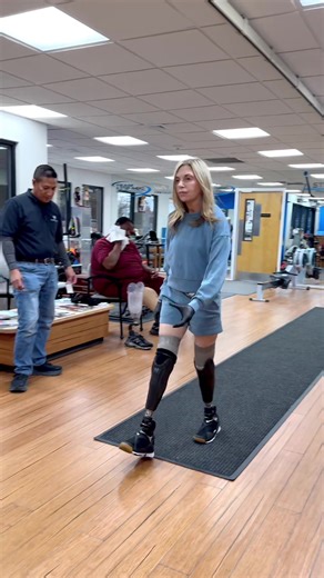 Ilysa: Quad Amputee's Journey with New Prosthetics