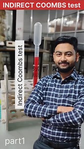 Indirect Coombs test practical||#labtechnician #coombs #indirectcoombstest #bscnursing #trendingreels #pathology #bloodtest | Rayyan Alam