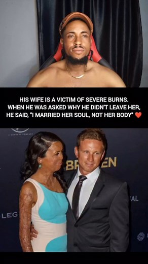 2.4K views · 25K reactions | Definition of true love!!❤️♥️♥️殺﫶✌️#viralvideos #reelvideo #pleaselikecommentandfollow❤️❤️please_guys_support_me_and_like_me_follow_me_please | Shawarmaboyreels | Facebook