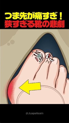 つま先が痛すぎ！狭すぎる靴の悲劇